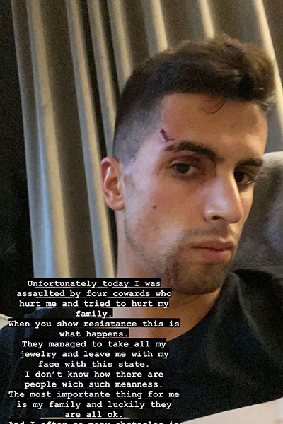 جواو كانسيلو يتعرض لاعتداء وحشي في منزله